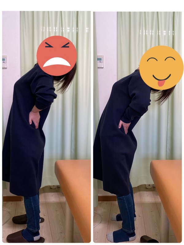 ★骨盤矯正でのbeforeAfter★
